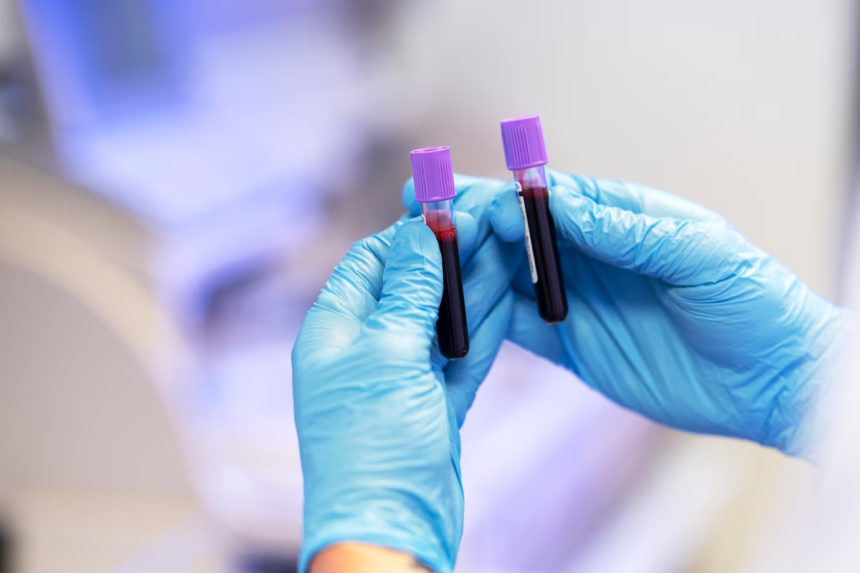 【基因檢測】DNA端粒長度反映細胞年齡?一文睇清端粒長度檢測及長壽秘訣!