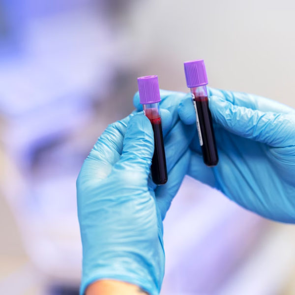 【基因檢測】DNA端粒長度反映細胞年齡?一文睇清端粒長度檢測及長壽秘訣!