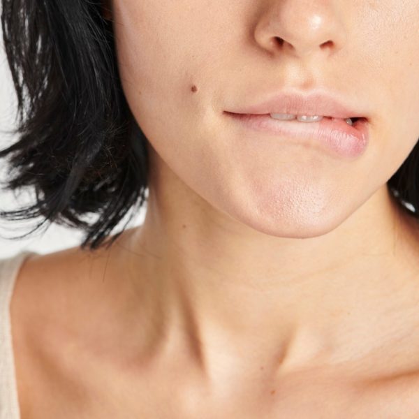 【暗瘡疤痕】重拾光滑肌膚!即睇對抗暗瘡疤痕的祕密武器!