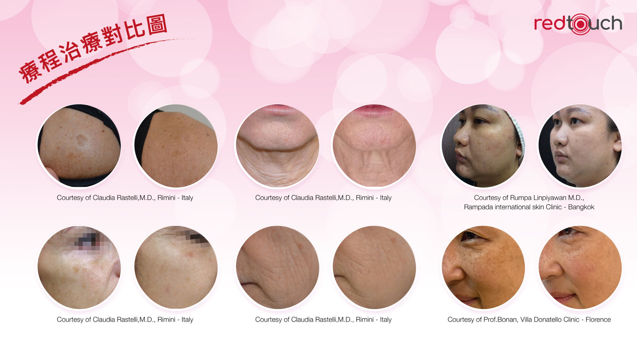 RT_ppt_chi-05.jpg#asset:1000