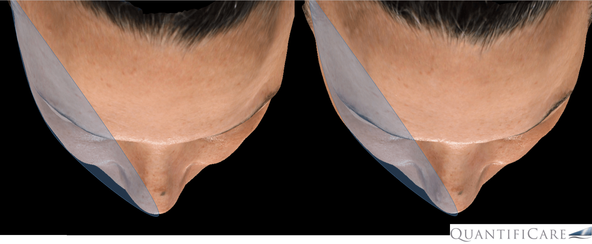 mini_002.png#asset:795