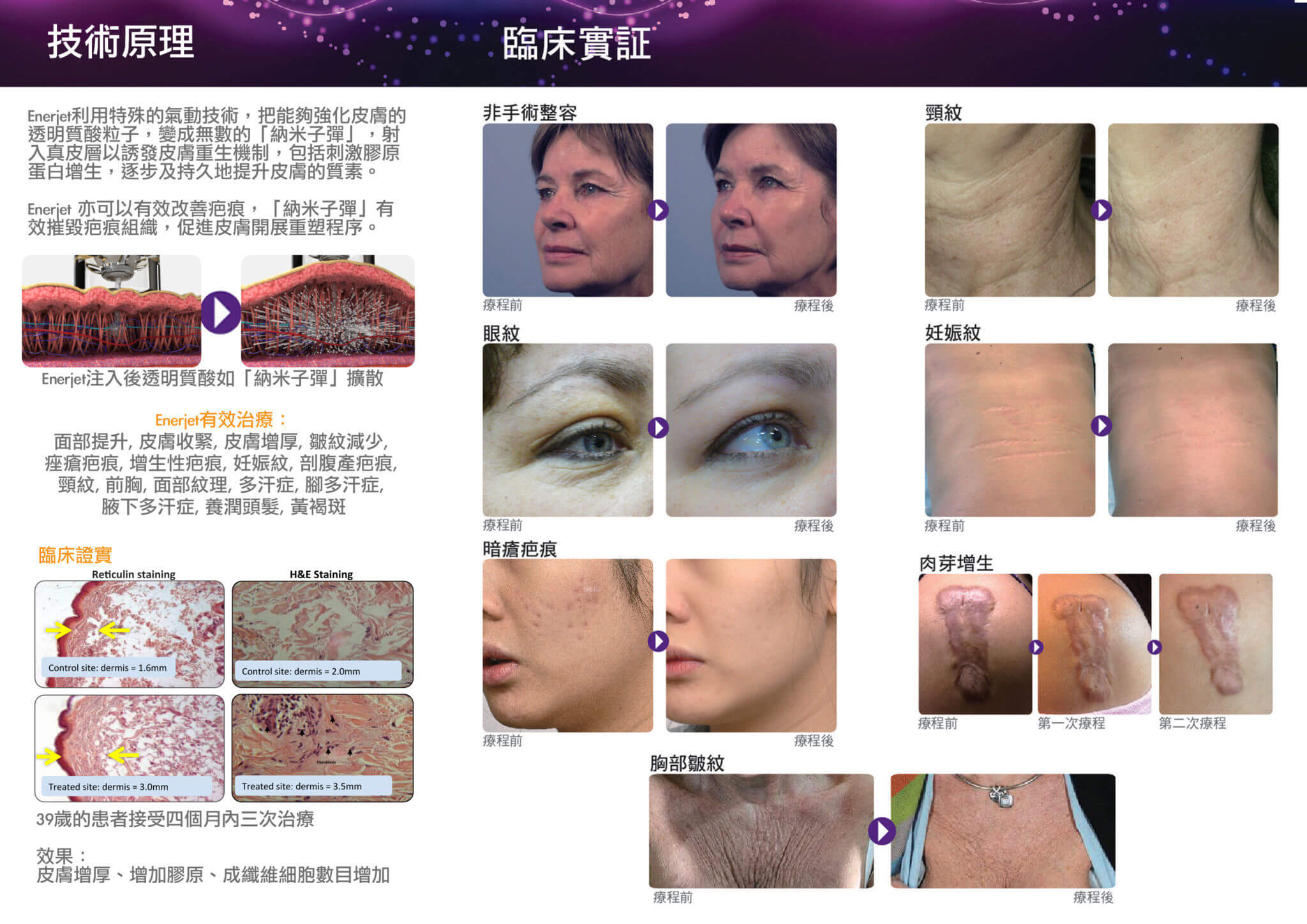 Good Union Enerjet Leaflet_2