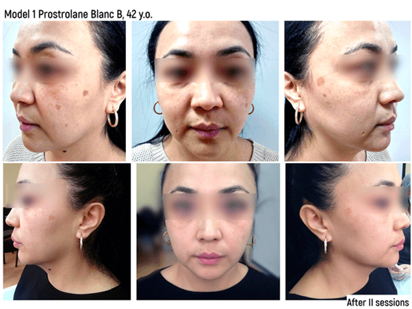 Blane-B4.png#asset:1215