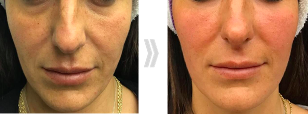 Nature-B8.png#asset:1223