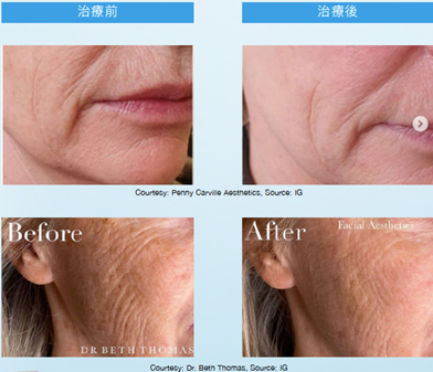 Teoxaner1-10.jpg.png#asset:1234