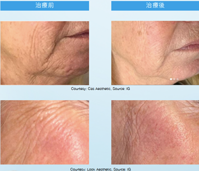 Teoxaner1-11.jpg.png#asset:1235