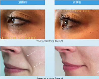 Teoxaner1-4.jpg.png#asset:1228