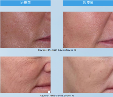 Teoxaner1-5.jpg.png#asset:1229