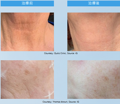 Teoxaner1-6.jpg.png#asset:1230