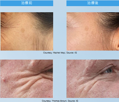 Teoxaner1-7.jpg.png#asset:1231