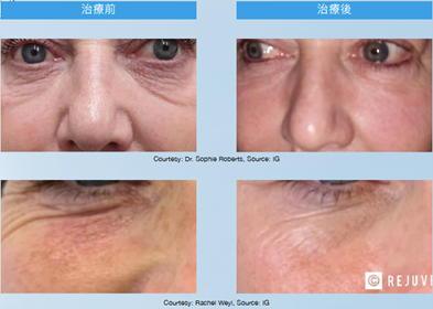 Teoxaner1-8.jpg.png#asset:1232