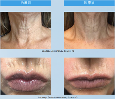 Teoxaner1-9.jpg.png#asset:1233