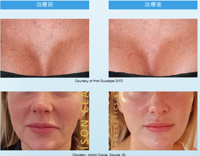 teoxaner1-3.png#asset:1227