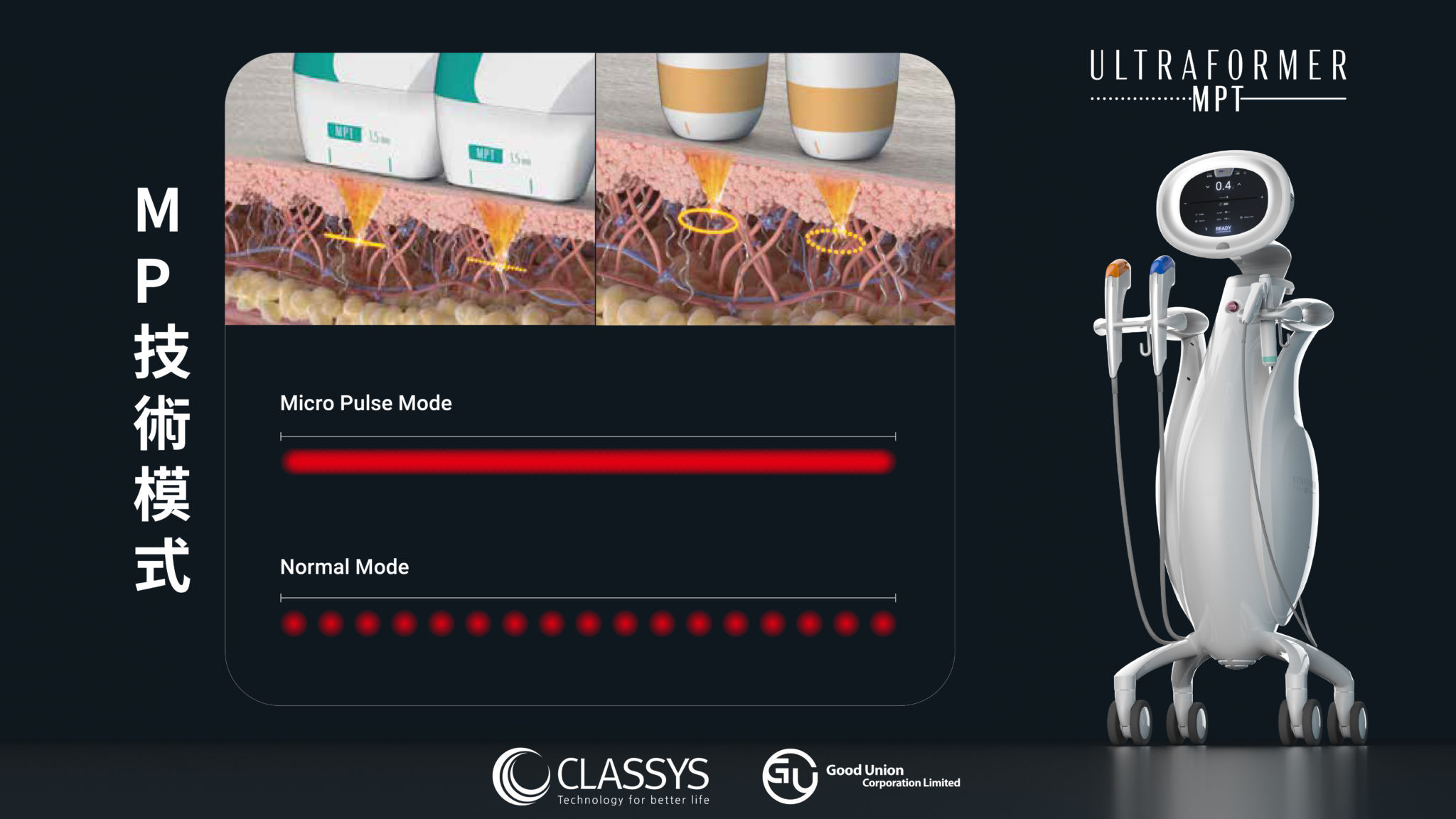 Ultraformer MPT - MP Mode