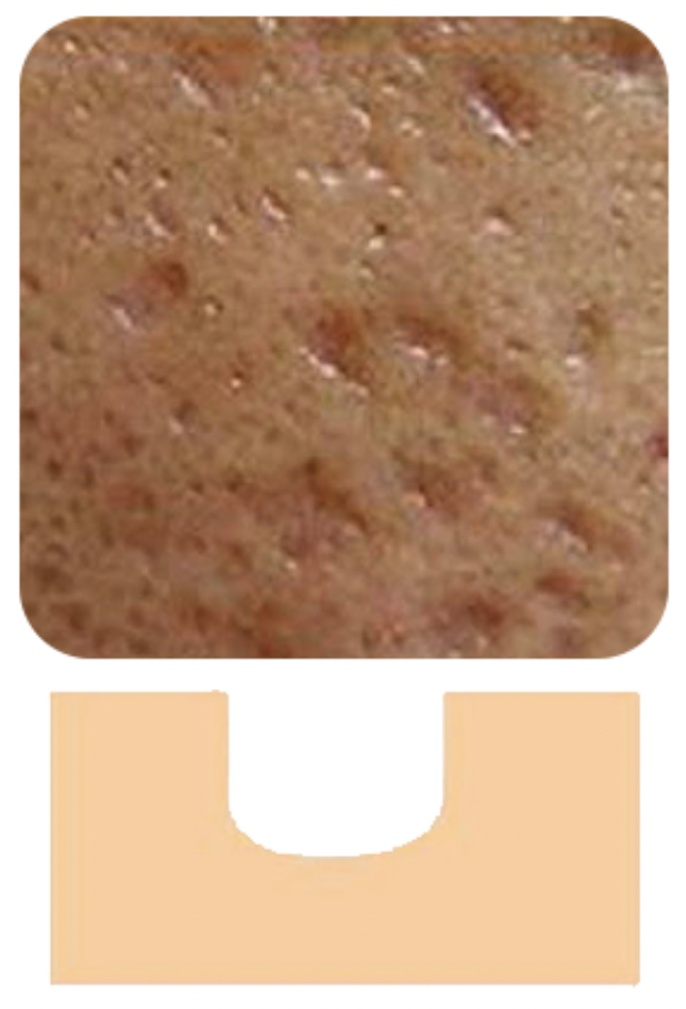 車廂型 (Boxcar Scars)