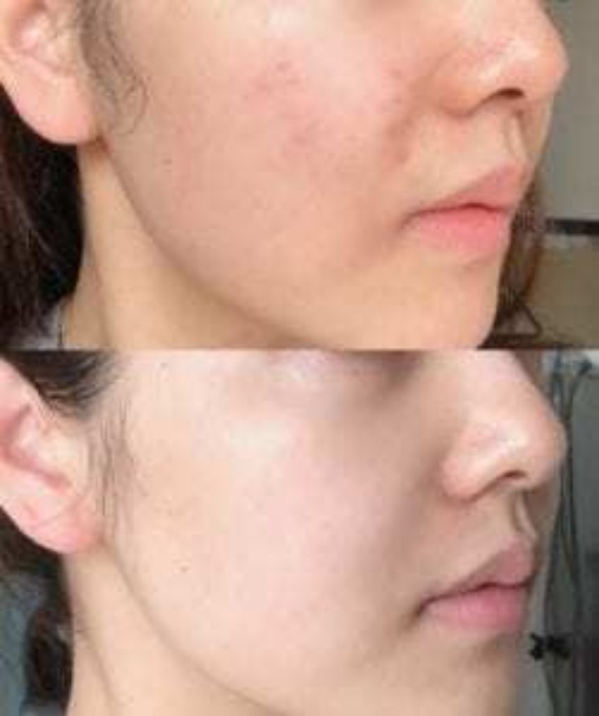 wwying3422 x Dr. Reborn