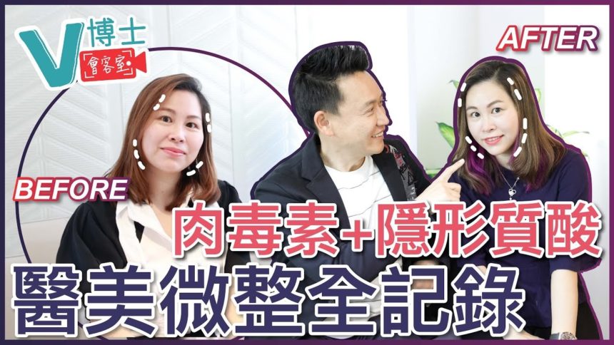 【V博士會客室】肉毒素+隱形質酸～醫美微整全記錄～同樣面部問題的女生可以參考一下！