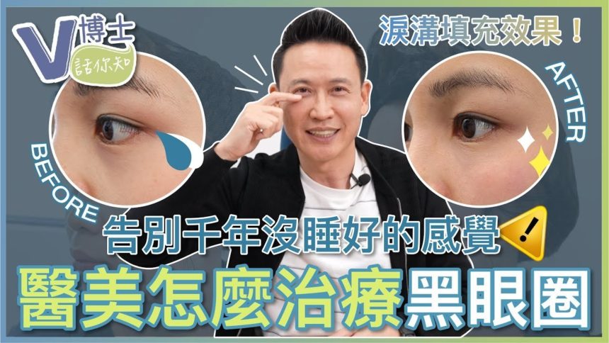 【V博士話你知】告別千年沒睡好的感覺！醫美怎麼治療黑眼圈？