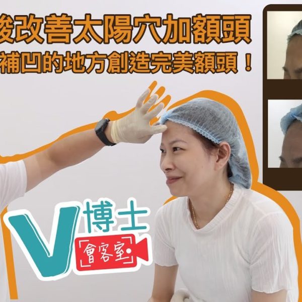 【V博士會客室】隱形質酸改善太陽穴及額頭？填補凹的地方創造完美額頭！同樣面部問題的女生可以參考一下！