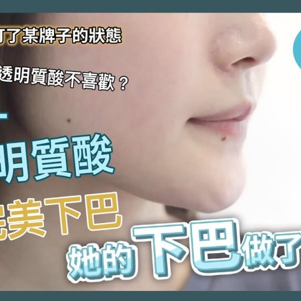 【V博士會客室】打完其他牌子的透明質酸不喜歡？！溶解+透明質酸～少女重造完美下巴～