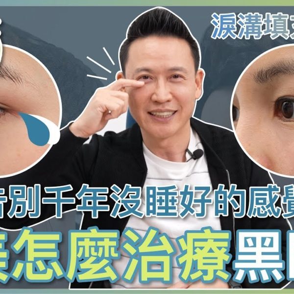 【V博士話你知】告別千年沒睡好的感覺！醫美怎麼治療黑眼圈？