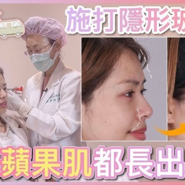 【V博士醫美遊】施打隱形玻尿酸！ 額頭蘋果肌都長出來了！網美實錄分享ft. iSKIN 尚行美健康聯合診所